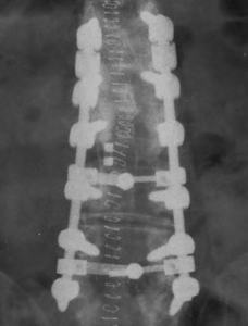 μετ2-resized